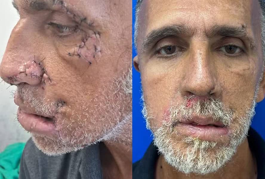 WhatsApp Image 2024-11-12 at 11.09.24 Catador sobrevive após ser atacado por dois pitbulls na Baixada Fluminense — Foto: Divulgação