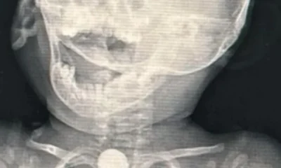 image_6487327-4-1000x600