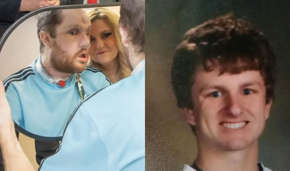 transplante-de-rosto_bdf749