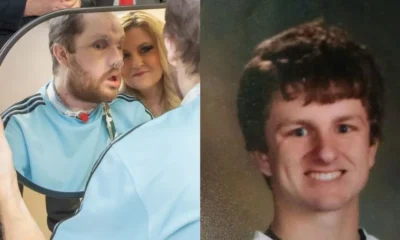 transplante-de-rosto_bdf749