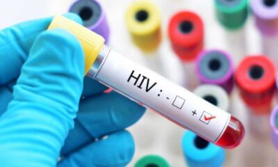 Oxford-inicia-testes-de-vacina-contra-o-virus-HIV