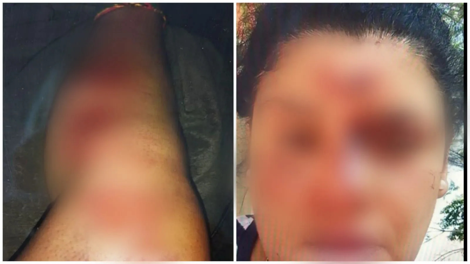 Justiça solta homem que estuprou e arrastou com trator mulher com deficiência