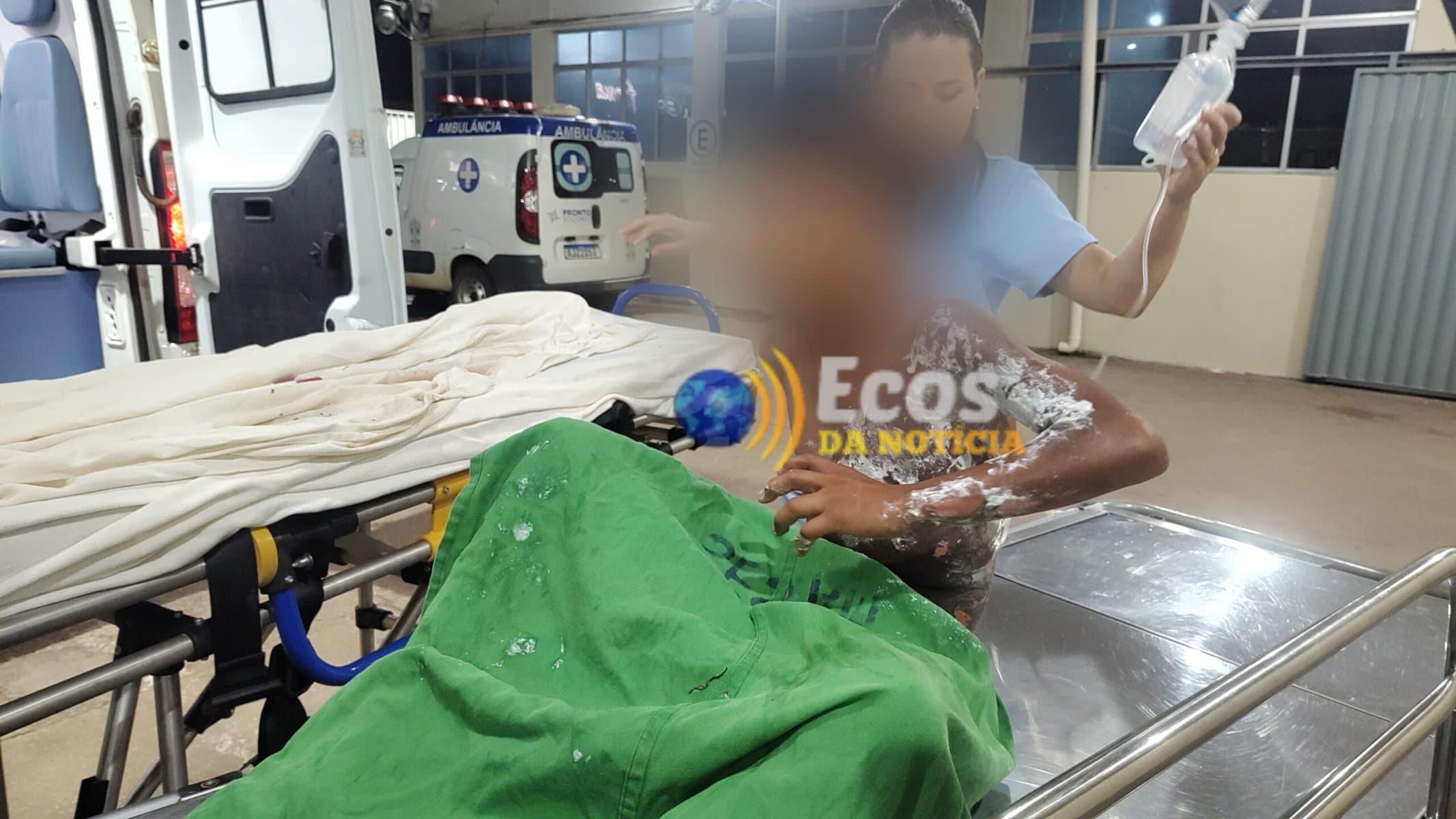 Criança Indígena sofre choque de alta tensão em Boca do Acre e é transferida para PS em Rio Branco