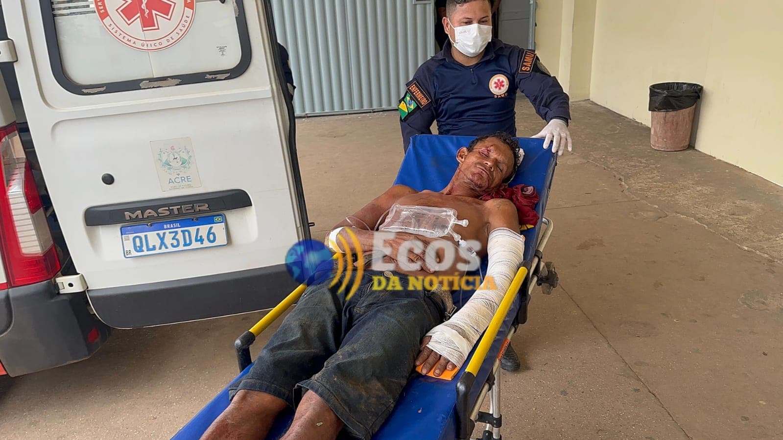 Homem é agredido com ripa e ferido de terçado ao tentar entrar na casa da ex-esposa em Rio Branco