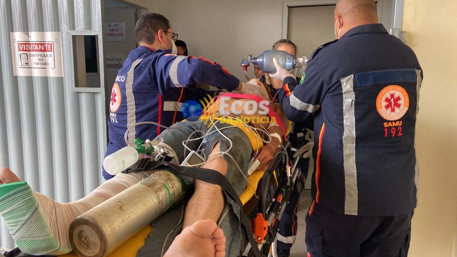 Colono sofre afundamento de crânio após colisão frontal entre motos em Sena Madureira
