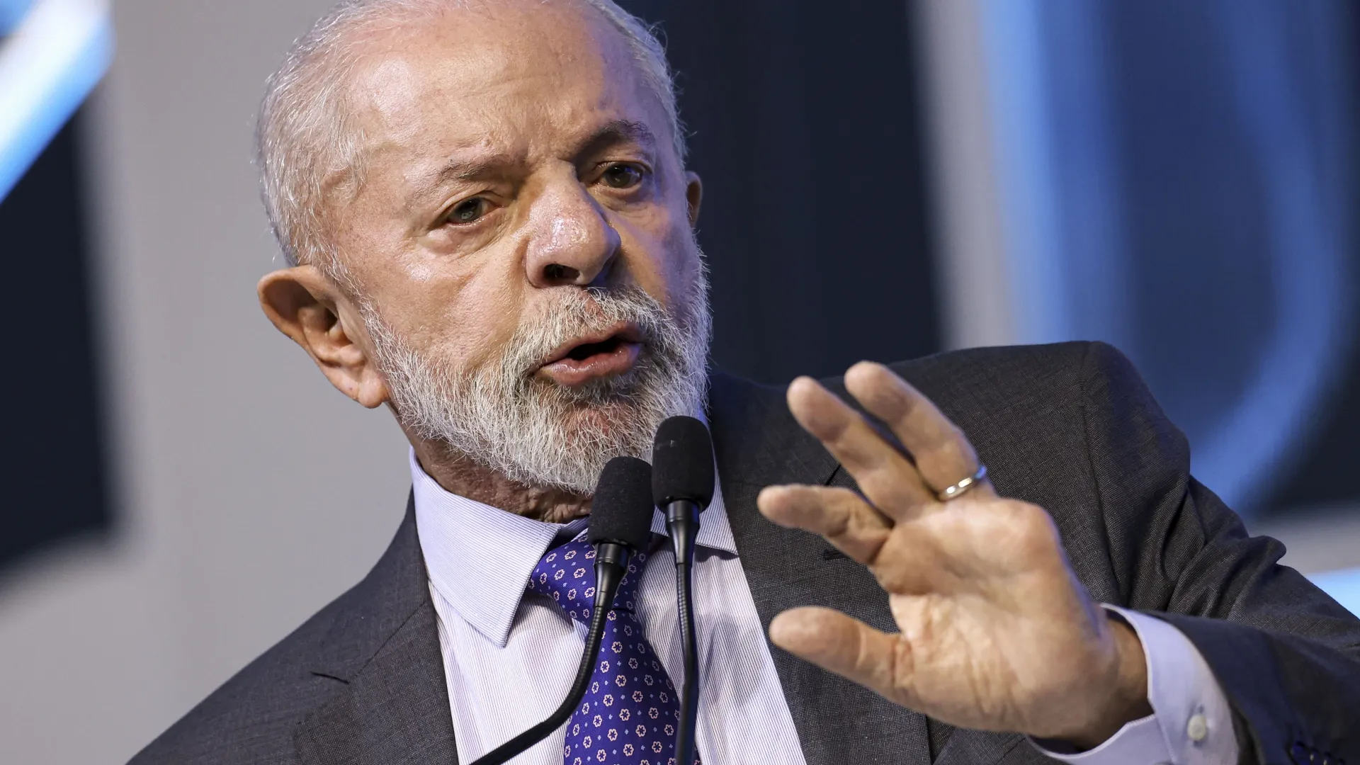 Entenda o que é craniotomia, procedimento ao qual Lula foi submetido em São Paulo