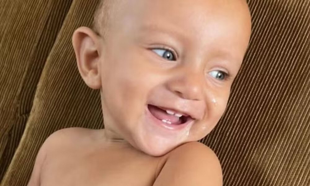 Nicolas Iglessia da Silva, de 11 meses, morreu no PS de Rio Branco por conta das queimaduras — Foto: Reprodução