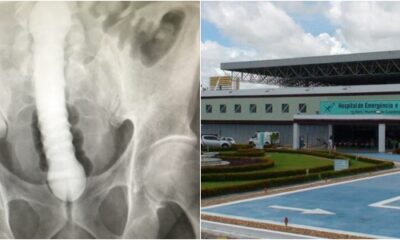 bddfd7555483e2caef48faadd9dd07d7 Crédito: Ilustrativa/Divulgação