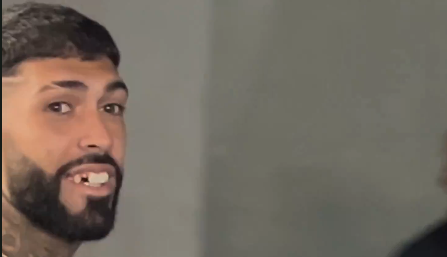 Barboza, do Botafogo, aparece sem dente após briga contra o Flamengo; veja