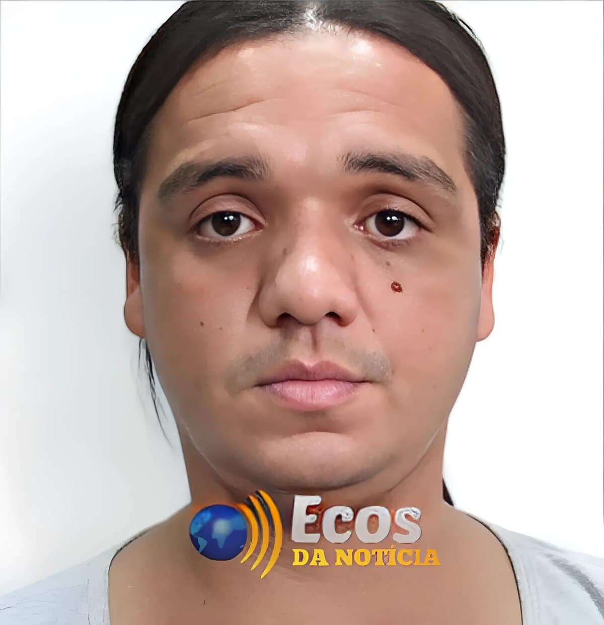 Mulher trans é esfaqueada e agredida no bairro 06 de Agosto