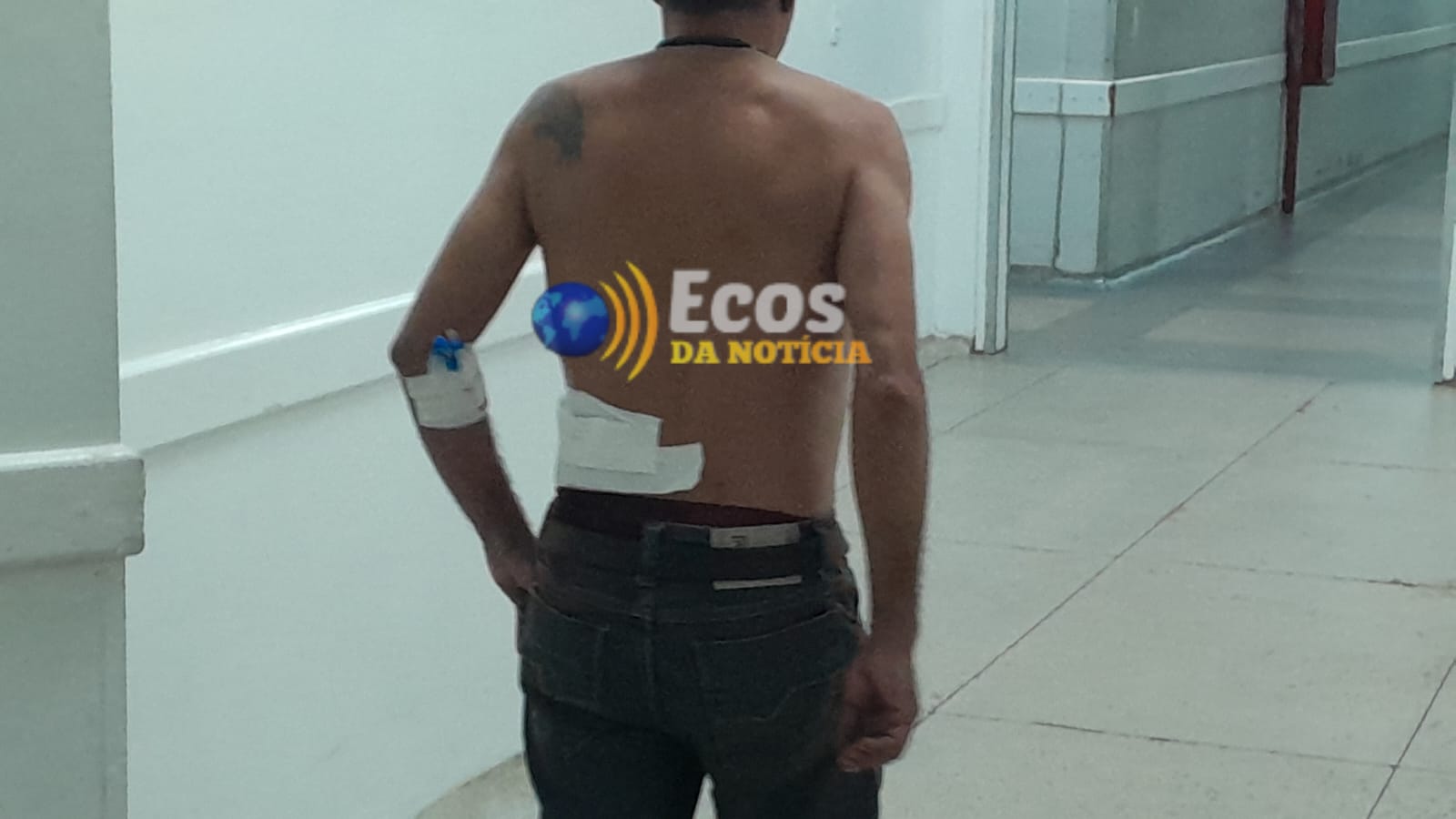 Na capital, motociclista é esfaqueado ao tentar salvar mulher de assalto; lâmina quebra dentro do corpo