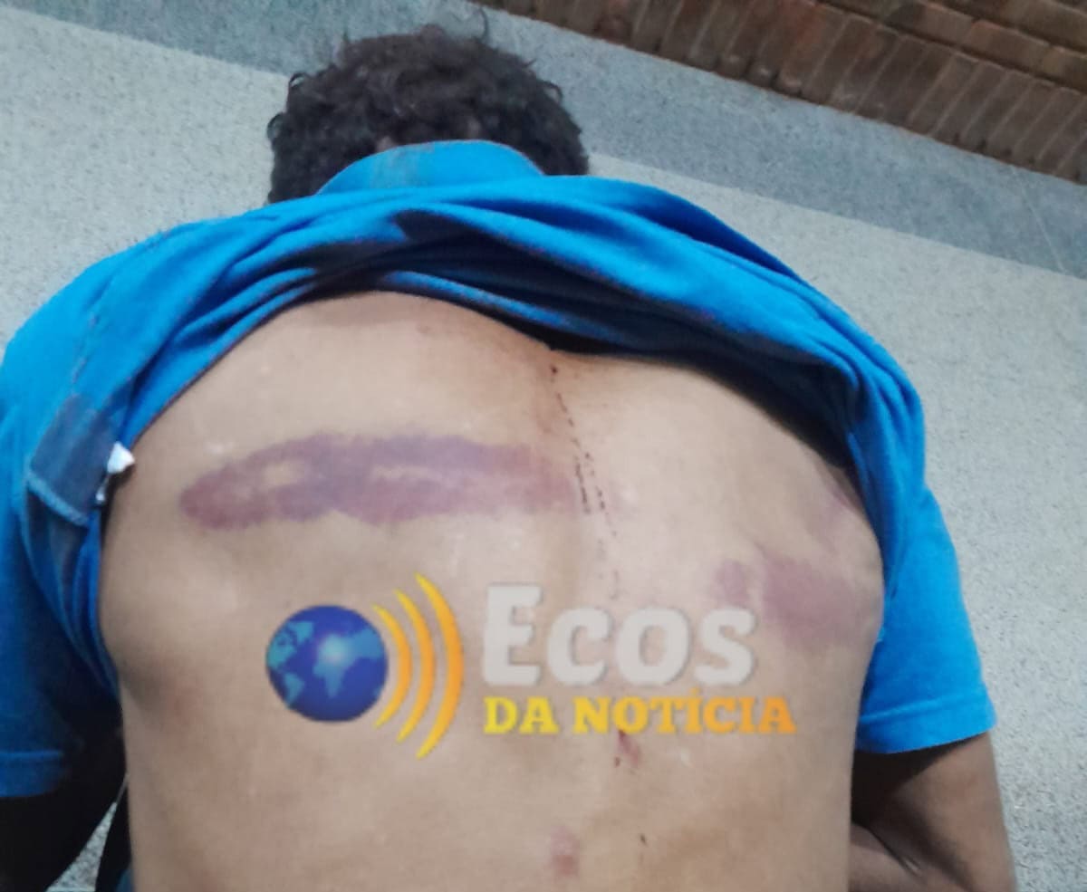 Morador em situação de rua é brutalmente agredido após ser acusado de furto em Rio Branco