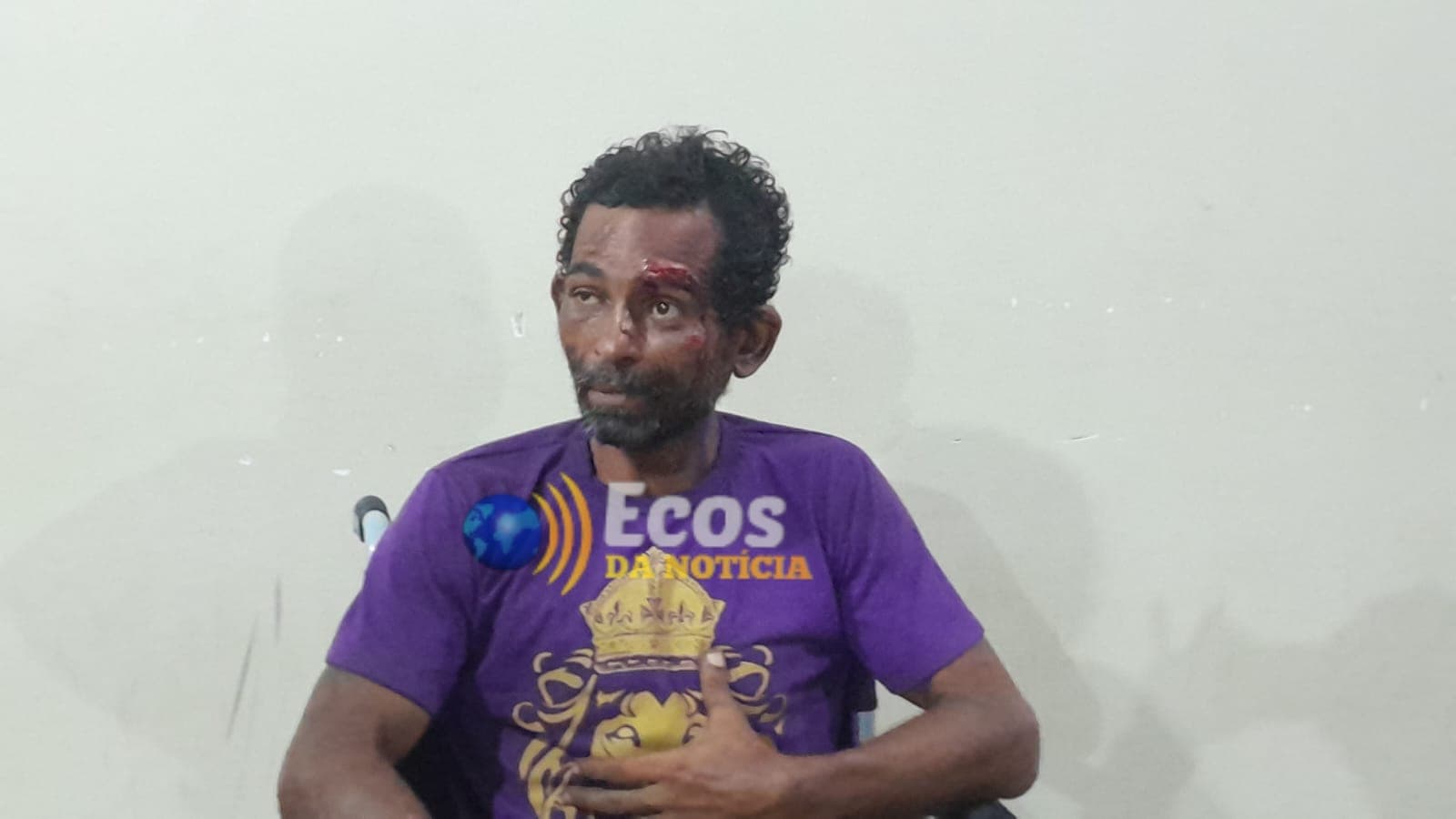 Morador de rua é agredido por facção criminosa após acusação de furto