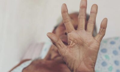 idosa-1-768×511 Imagem ilustrativa