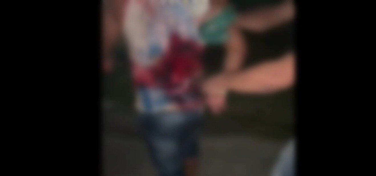 Violência extrema: homem caminha com faca cravada nas costas no AM; veja vídeo