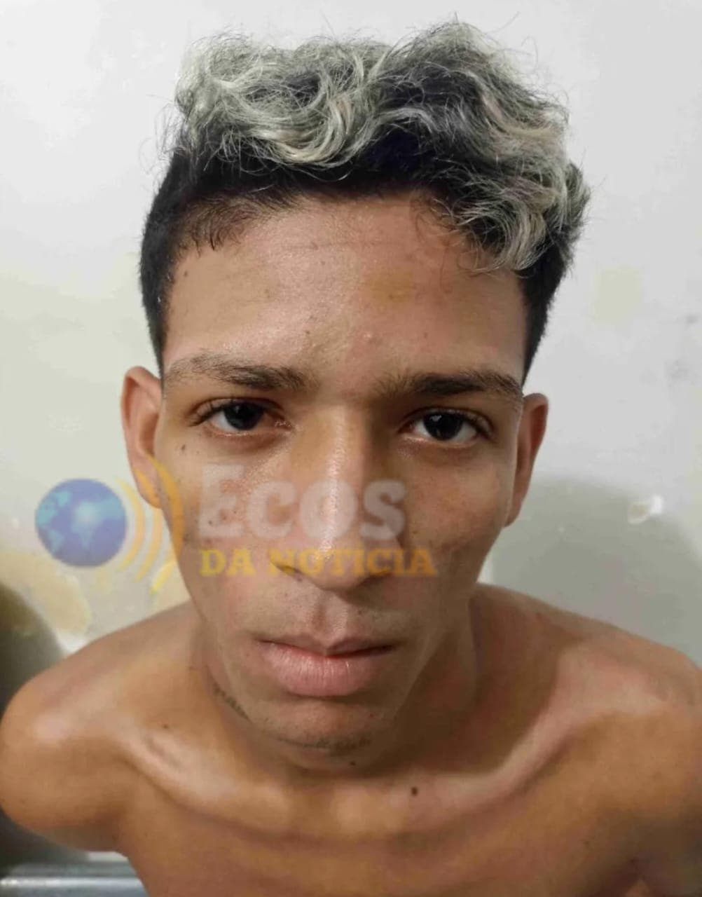 Criminoso que matou vigilante durante roubo em escola é extubado e está consciente na UTI