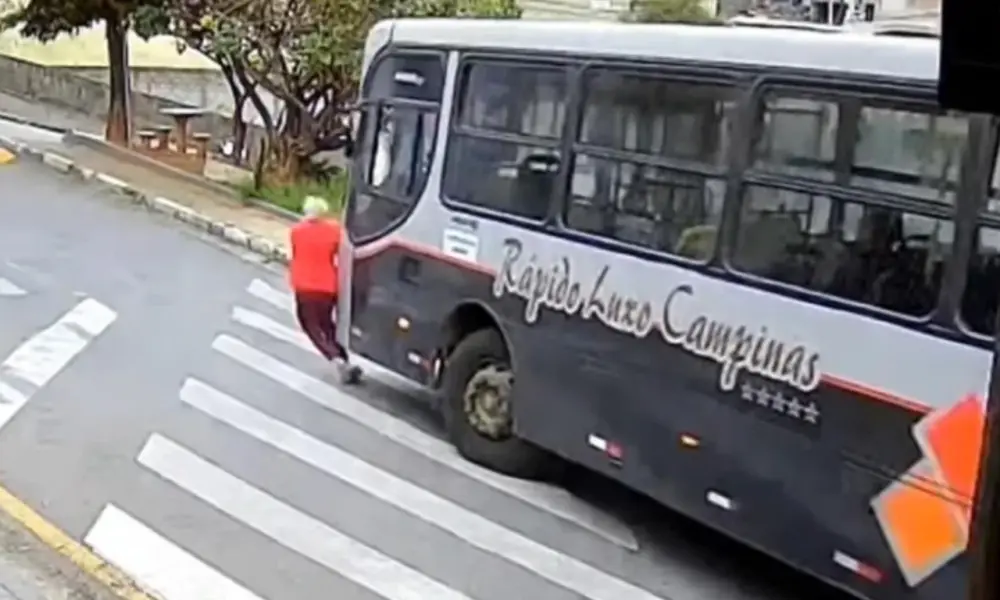 idosa-pernas-amputadas O ônibus passou por cima das pernas da idosa, que precisaram ser amputadas (Foto: Reprodução/Redes Sociais)