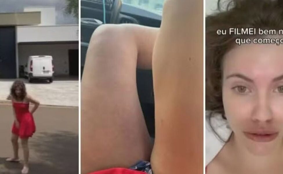 influencerdoente Sarah Femina relembra diagnóstico de trombose e internação: "Pior dor que já senti"  |   Bnews - Divulgação Reprodução Redes sociais