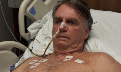 jair-bolsonaro-internado-cirurgia-20abr2025-848×477-1 Reprodução/Instagram @jairmessiasbolsonaro