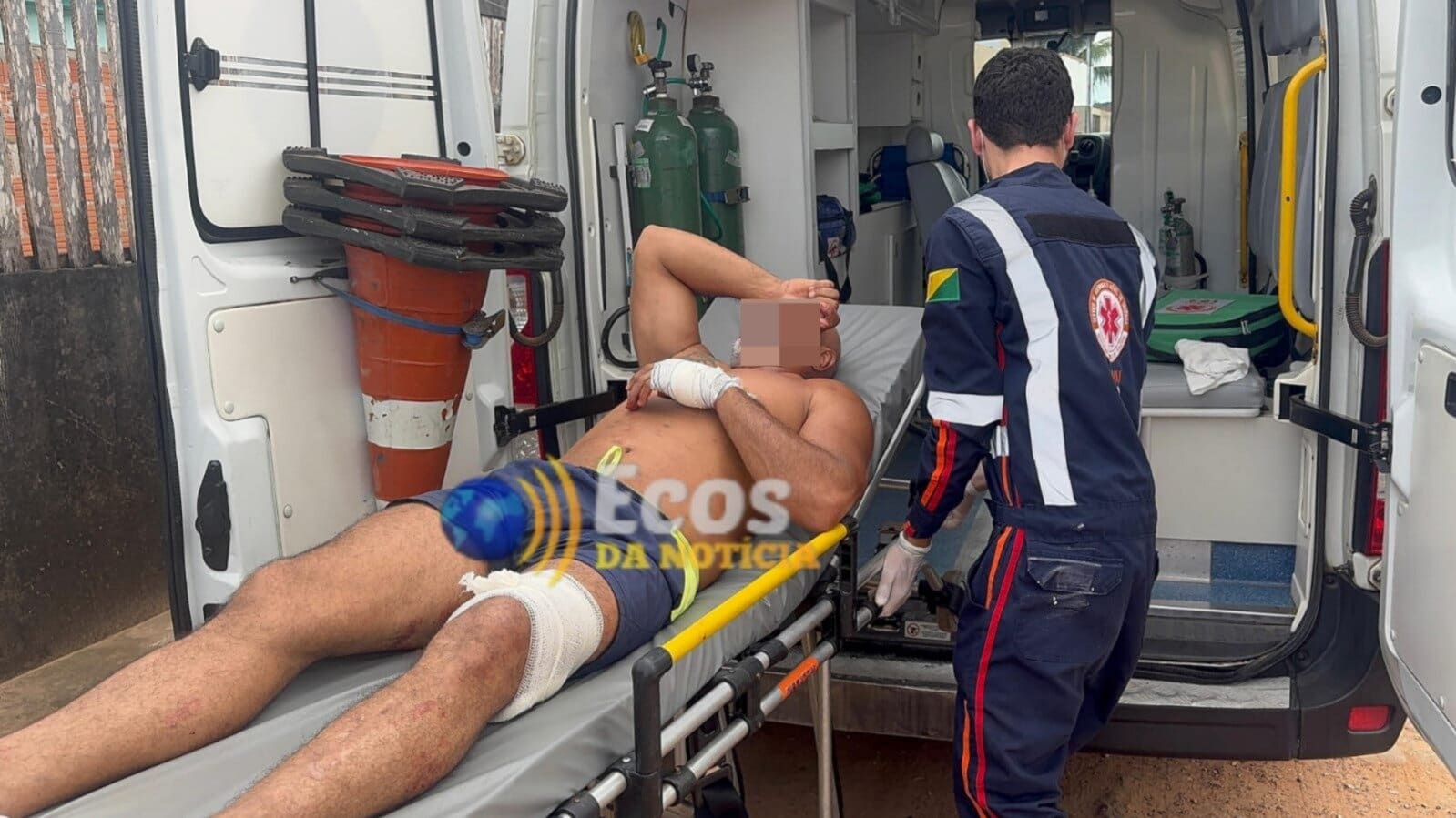 Sargento da PM do Acre é baleado acidentalmente ao manusear arma